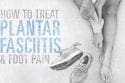 How To Treat Plantar Fasciitis