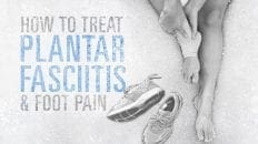 How To Treat Plantar Fasciitis