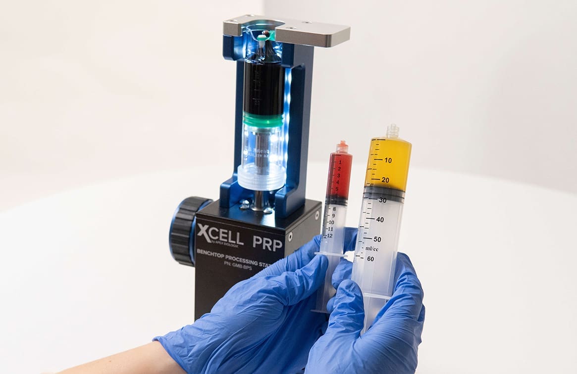 PRP, PRF, Bone Marrow Biologics